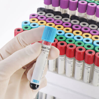 kaufen Vakuum-EDTA-Blutröhrchen für das vollständige Blutbild (CBC) on-line-Fertigung